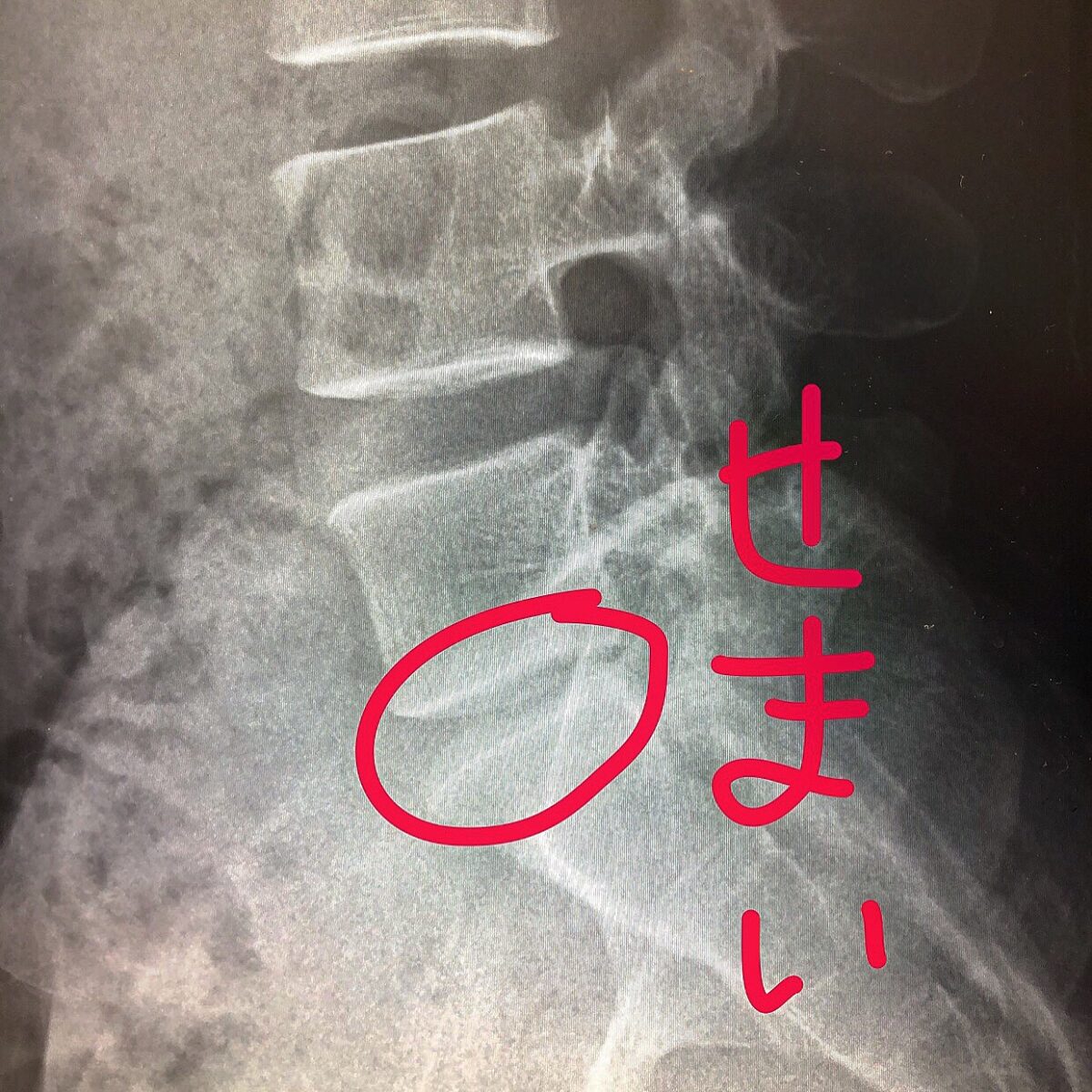 ヘルヘル ヘルヘル